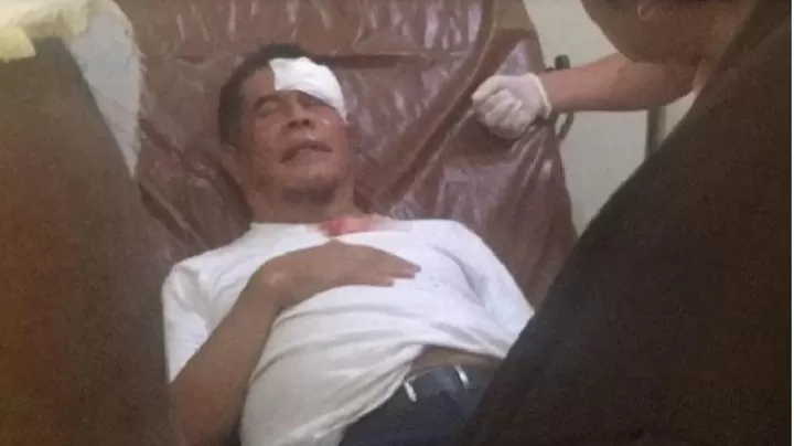 Pj Gubernur Papua Ridwan Rumasukun terluka di kepala dilempar batu pengantar jenazah Lukas Enembe (Dok Istimewa)