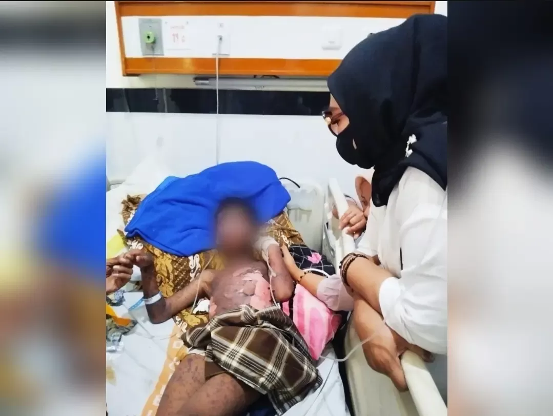 Kades Bendungan Jenguk Warganya Derita Penyakit Aneh, DPRD Minta RSUD Cileungsi Beri Perhatian Khusus