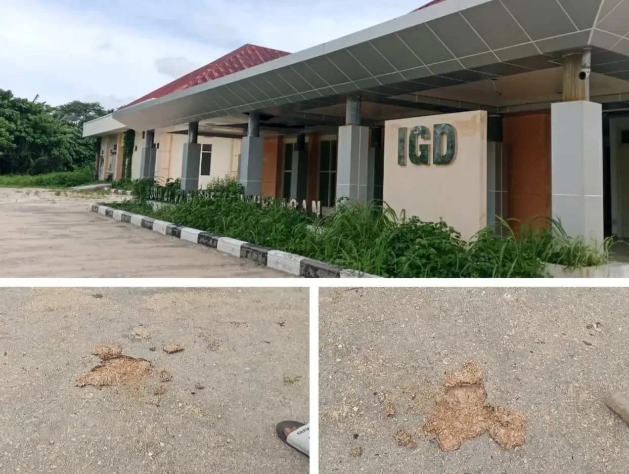 Proyek Parkir RSUD PP Magretti: Anggaran Fantastis, Kualitas Minim