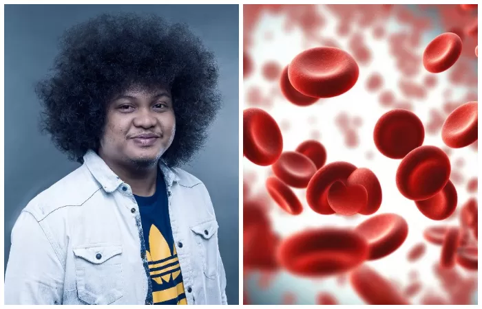 Anemia Aplastik Penyakit Langka yang Di derita Babe Cabita Sejak 2023