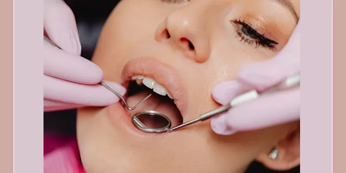 Ilustrasi perawatan karang gigi atau scaling. (Pexels/Kaboompics.com) 