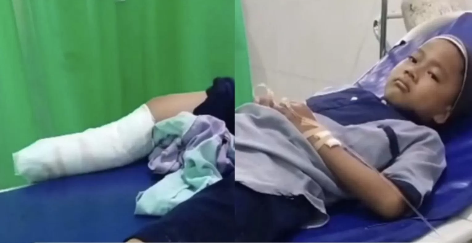 Bocah ini alami kecelakaan hingga kehilangan kakinya (Twitter(X)/@kegblgnunfaedh)
