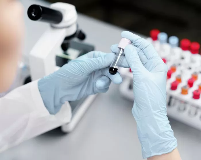 Fakta unik golongan darah manusia (Freepik.com/freepik)