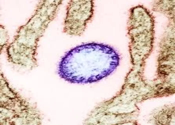 Virus nipah