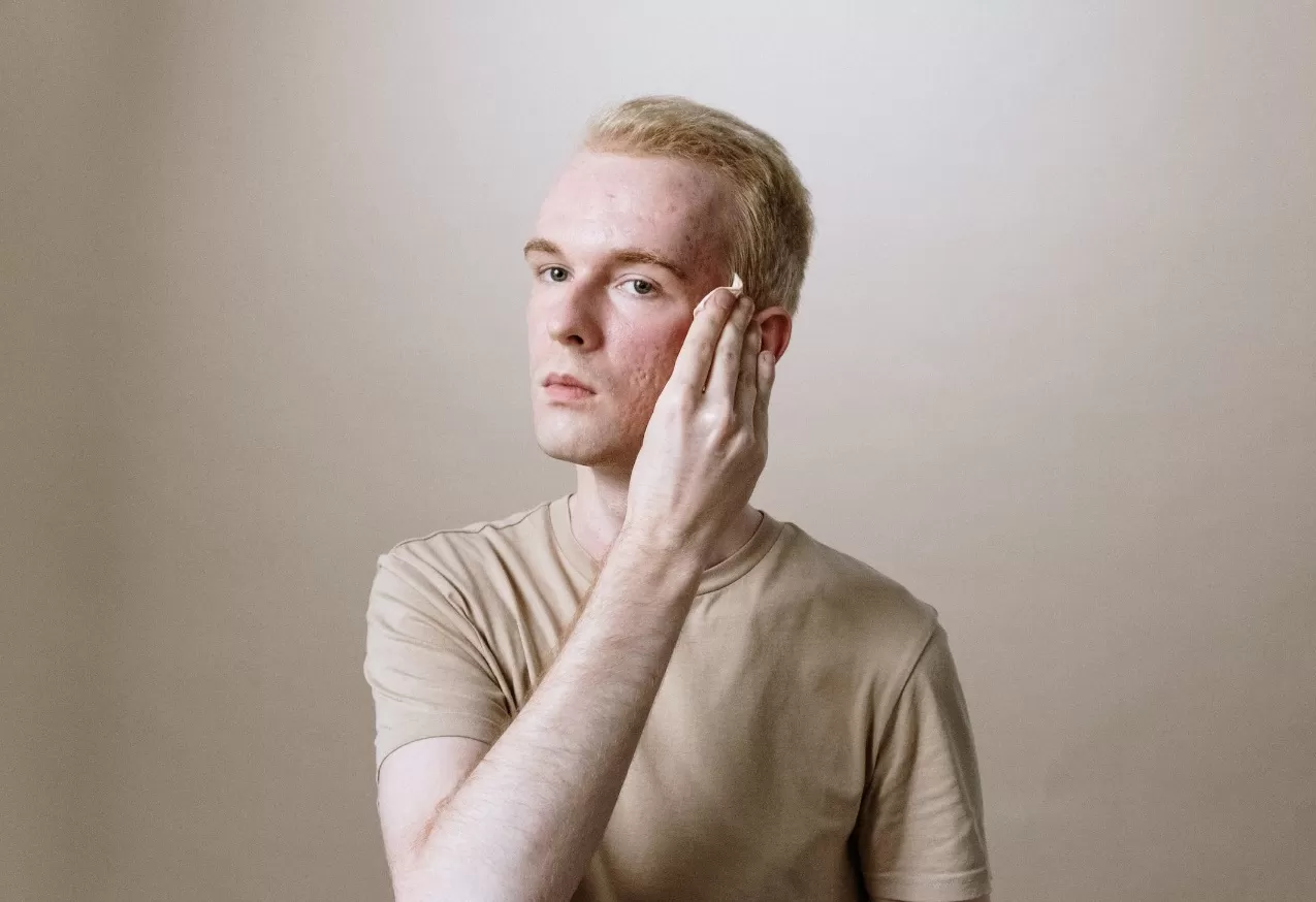 Membersihkan wajah dengan bahan alami. (Pexels / Cottonbro Studio)