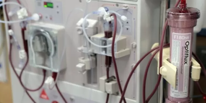 Ilustrasi alat dialisis di rumah sakit. (Pinterest / evelyn hale)