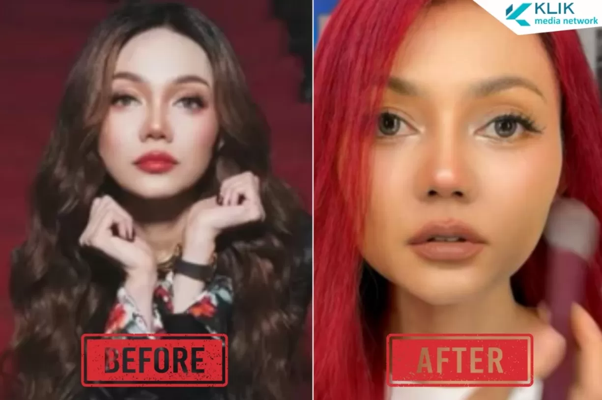 Tampil dengan Wajah Baru, Ini Alasan Rina Nose Operasi Plastik Hidung Usai 10 Tahun Jadi Ciri Khas Berkarier - Klik Media Network