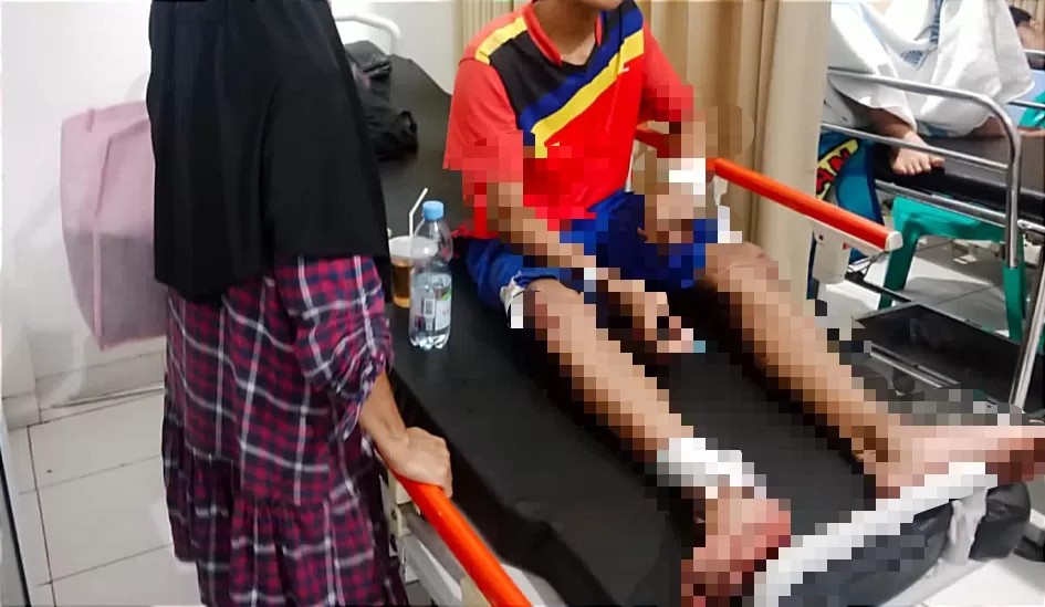 Korban bacokan senjata tajam Geng Motor dirawat di RSUD R Syamsudin SH Kota Sukabumi  (TatarMedia.ID - Rapik Utama)