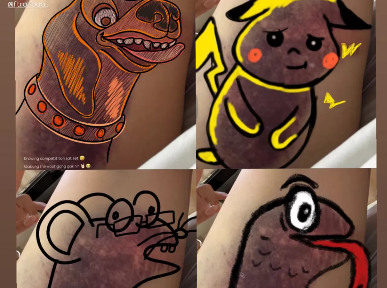 Kocak! Wendy Walters Adalan Lomba Gambar Lebam Usai Kecelakaan (instagram) (puspita )