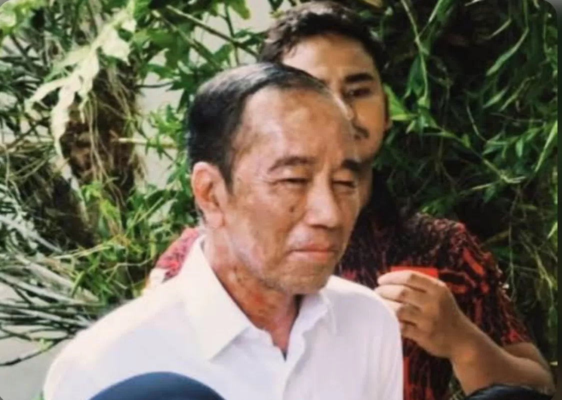 fakta penyakit jokowi  (puspita)