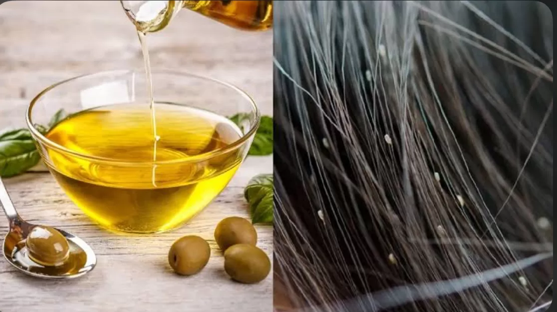 cara menghilangkan kutu rambut  (puspita)