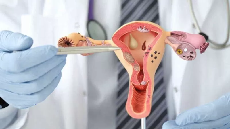 Ilustrasi Serviks (Foto: Primaya Hospital)