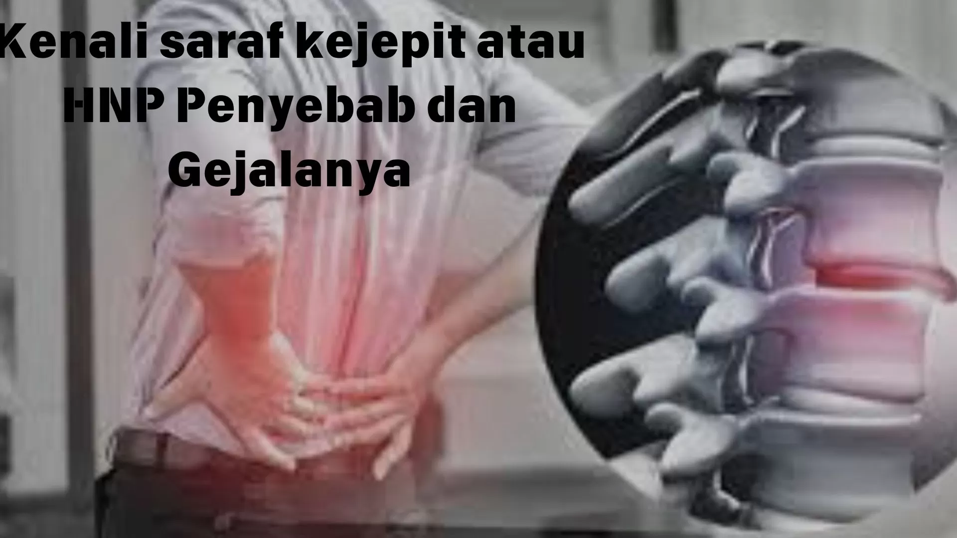 Perlu Waspada! Inilah 8 Penyebab Bahaya Syaraf Terjepit, Bagaimana Tips ...