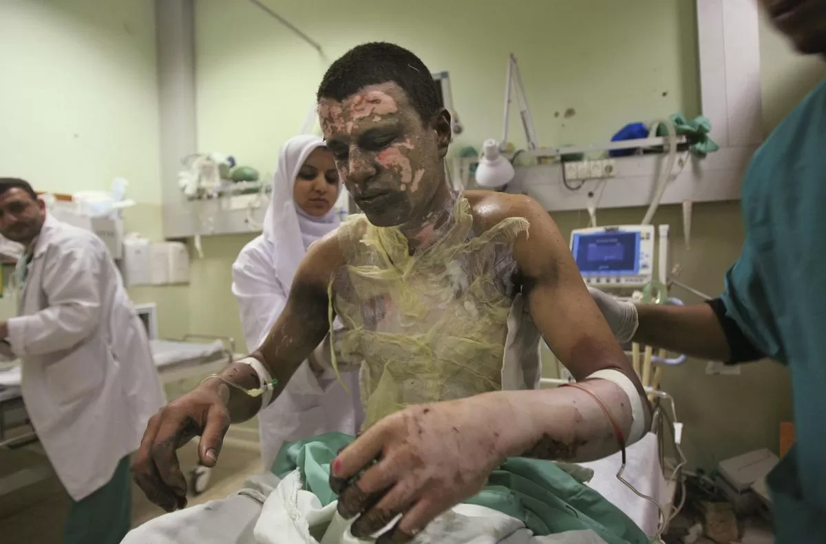 Pasien di Palestina yang terkena bom fosfor putih. (Istimewa)