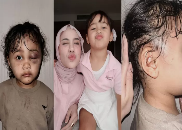 Heboh! Anak Selebgram Aghnia Punjabi Dianiaya Babysitter, Begini Pesan ...