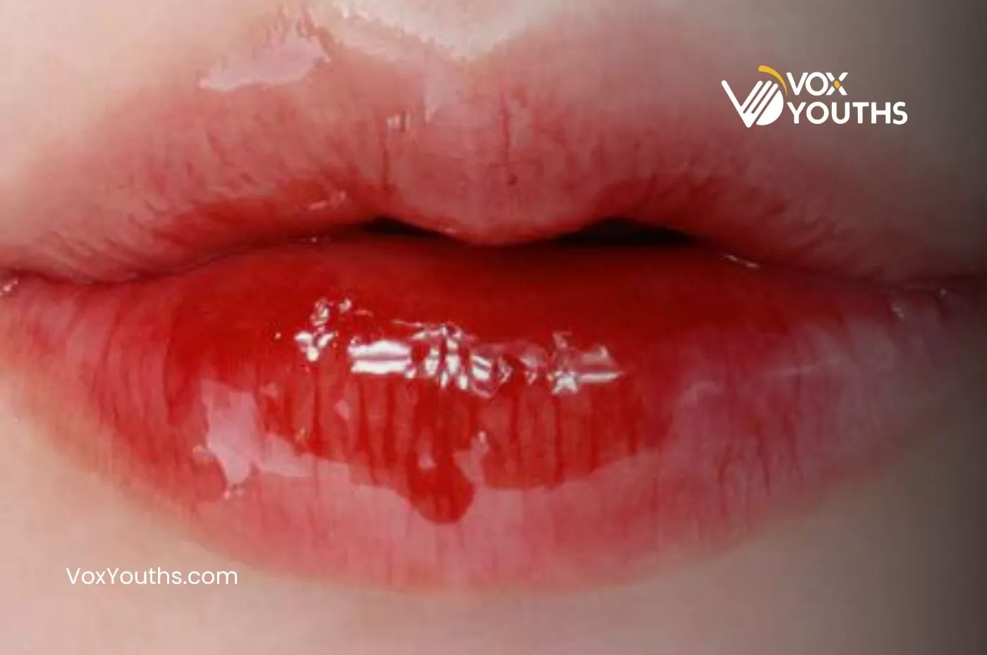 Rahasia Bibir Lembut Dan Sehat Dengan Rekomendasi Lip Balm Terbaik Vox Youths