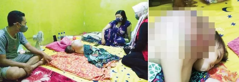 KASIHAN: Kondisi balita Yasmin saat ini menunggu penanganan medis lebih lanjut