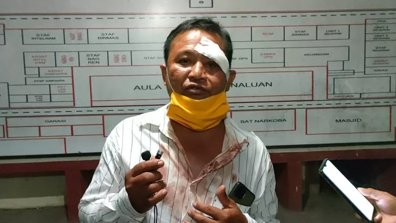LAPOR : Korban dalam kondisi luka pasca dianiaya oknum anggota DPRD Kabupaten Bengkayang melapor ke Sat Reskrim Polres Bengkayang, pada Senin (19/4) malam. SIGIT ADRIYANTO/PONTIANAK POST