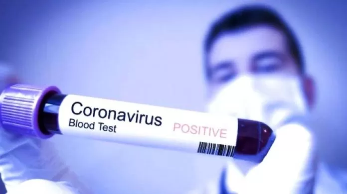 Virus corona yang telah membuat geger masyarakat dunia. | Foto: Net/Ist.