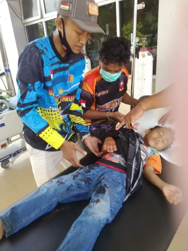 BERDARAH: Seorang anak menjadi korban seekor warik mengamuk di Pandan Arum, Kelurahan Belimbing, Kecamatan Murung Pudak, Kabupaten Tabalong, Selasa (6/10). | Foto: Istimewa