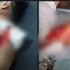 Puasa Berdarah di Kindang, Bapak dan Anak Baku Parang Hingga Sama-Sama Terluka