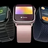 Apple Keluarkan Smart Watch Terbaru : Apple Watch Series 9