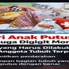 Jari Kelingking Anak Putus Diduga Digigit Monyet, Ini Kronologinya