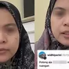 Ucapan Nirempati Berujung Duka Kepulangan Pasien BPJS, Jadi Pelajaran bagi Nakes untuk Punya Sisi ‘Einfuhlung’