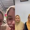 Bikin Geram! Dua Pegawai SPPG Galang Barat 2 Cemooh Korban Keracunan MBG, Sebut Gejala Terjadi Saat Mengkonsumsi Telur