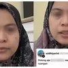 Empati yang Terlambat: Nakes Pengomentar “Potong Nadi” Pasien BPJS Baru Meminta Maaf Setelah Korban Meninggal