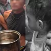 Kasus Dugaan Penganiayaan Anak 2 Tahun oleh Ayah Kandung di Padang, Polisi: Kakinya Kena Air Panas dan Bekas Gigitan