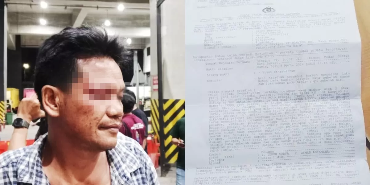 Seorang driver Shopee Xpress tampak mengalami luka lebam setelah diduga dikeroyok pada 9 April 2026, sebelum akhirnya melapor ke Polsek Medan Satria sehari setelah kejadian. (mame/metropolitan)