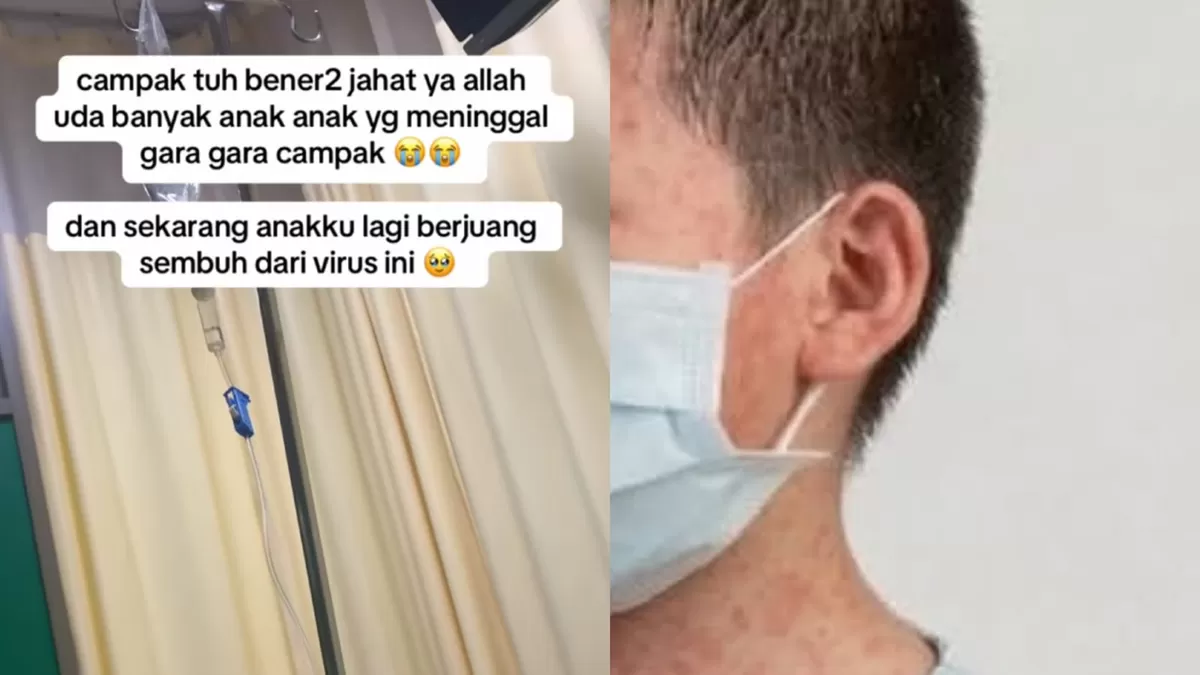 Viral cerita pilu orang tua anak yang terkena campak. (TikTok/dheaaputri_ - Instagram/kemenkes_ri)