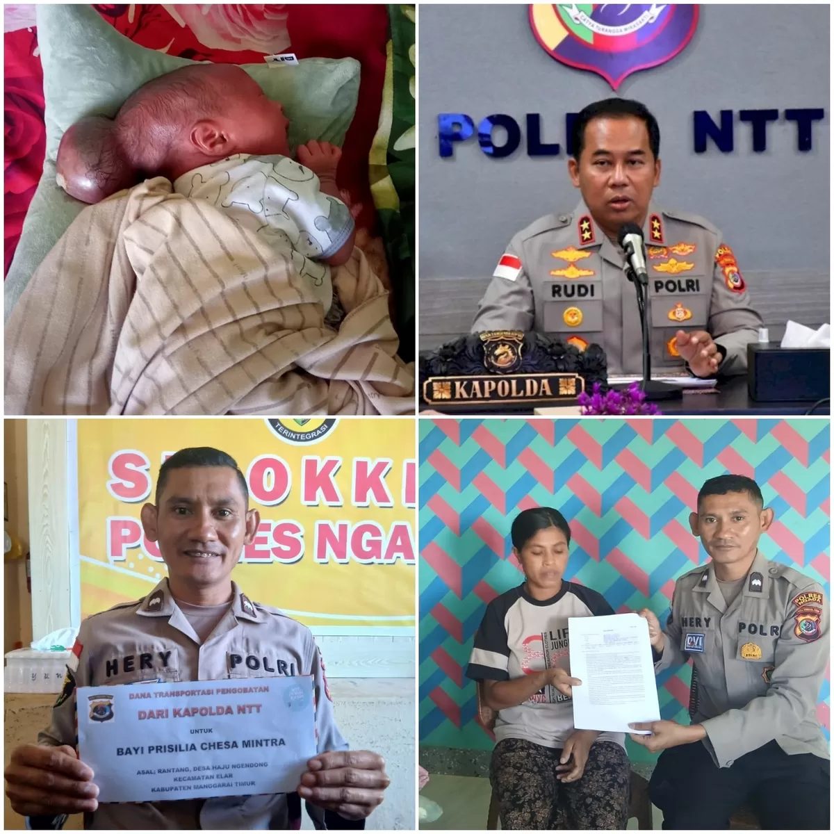 Tersentuh Kisah Prisilia, Kapolda NTT Irjen Pol Rudi Darmoko Kirim Bantuan: "Segera Bawa Bayi Ini ke Kupang" (Foto: Jhi. S)
