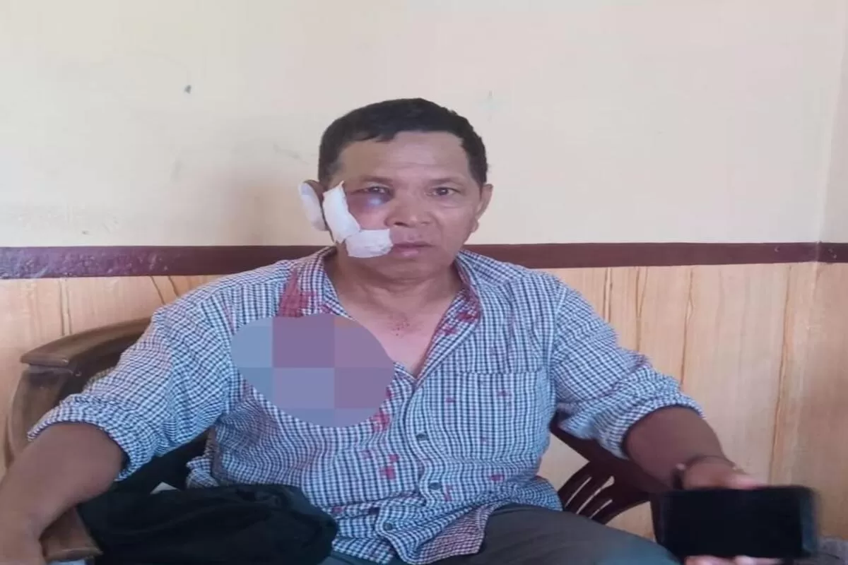 Arnoldus Bbot, Korban Pengeroyokan Pascapilkades Ranaka pada 8 Oktober 2026 (Dok.Ide Nusantara)