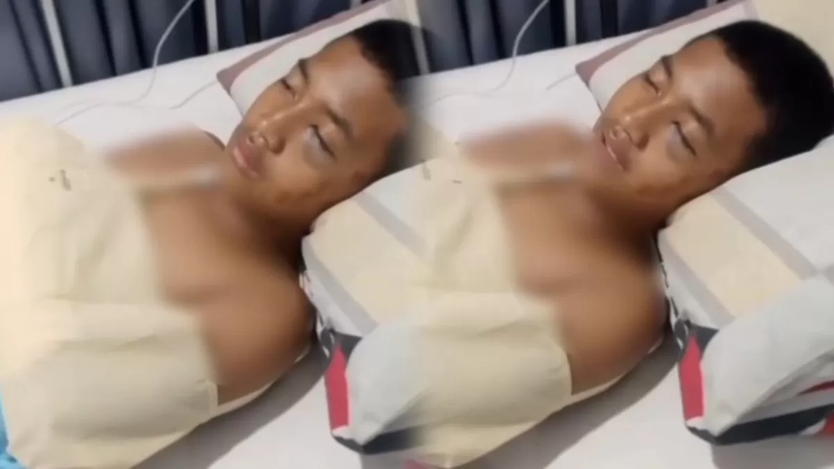 Efek Bius Bikin Ngigau, Pria Ini Mimpi Dikasih Rp10 Juta oleh Pak Dedi. (TikTok/@mamih_turky)