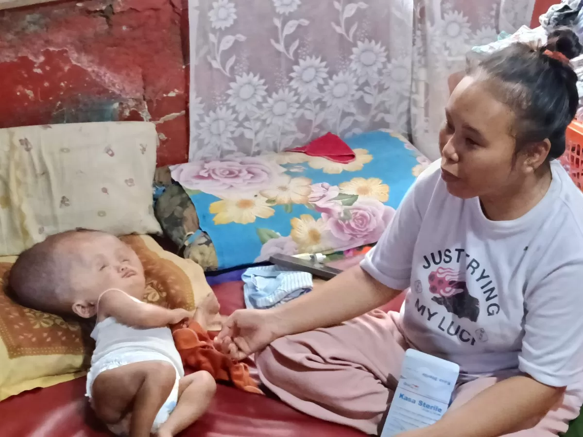 Tia Haryanti (kanan) mendampingi anaknya, Muhammad Goffi Abdullah Irawan, bayi pengidap hidrosefalus di kediamannya di Subang, Jawa Barat