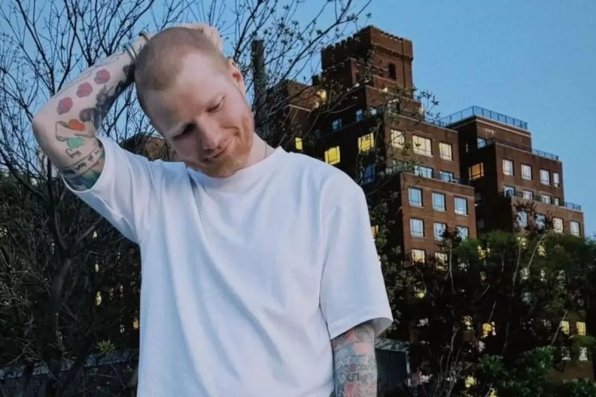 Ed Sheeran Ungkap Sempat Idap Herpes Zoster, Penampilannya Kini Bikin Pangling (Istimewa)
