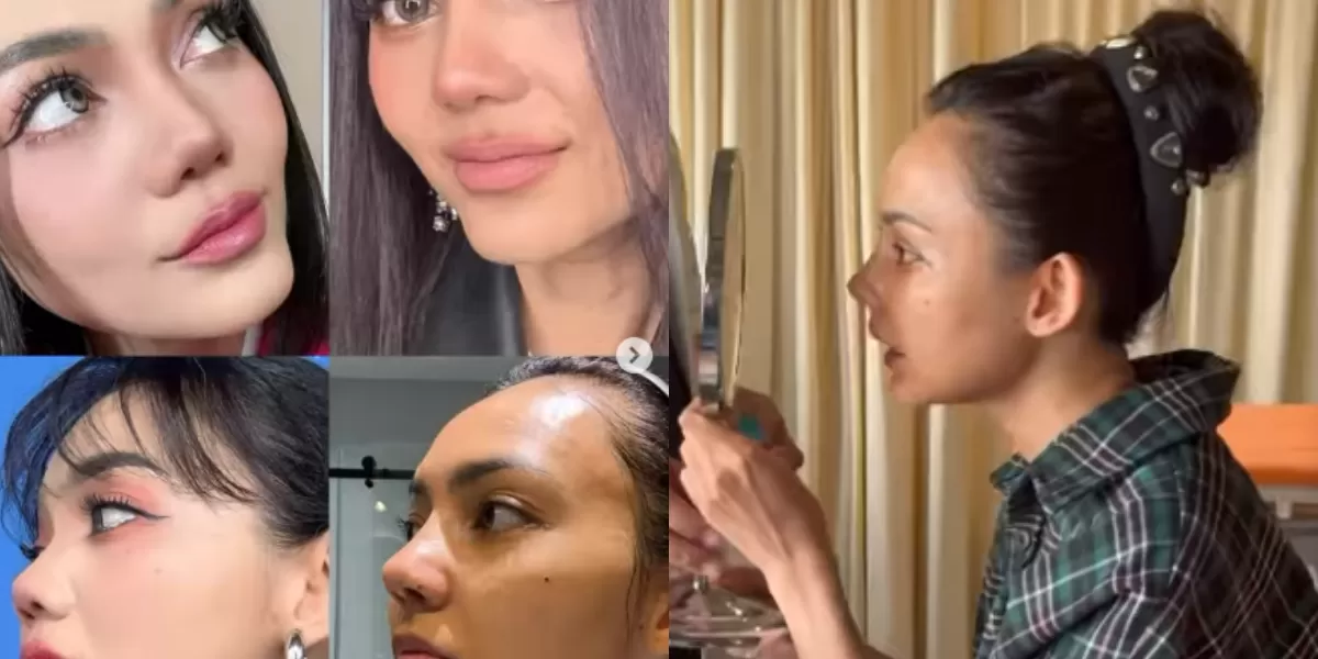 Potret hidung Rina Nose setelah dioperasi plastik. Ungkap alasan di balik keputusannya tersebut. (Instagram/rinanose16)