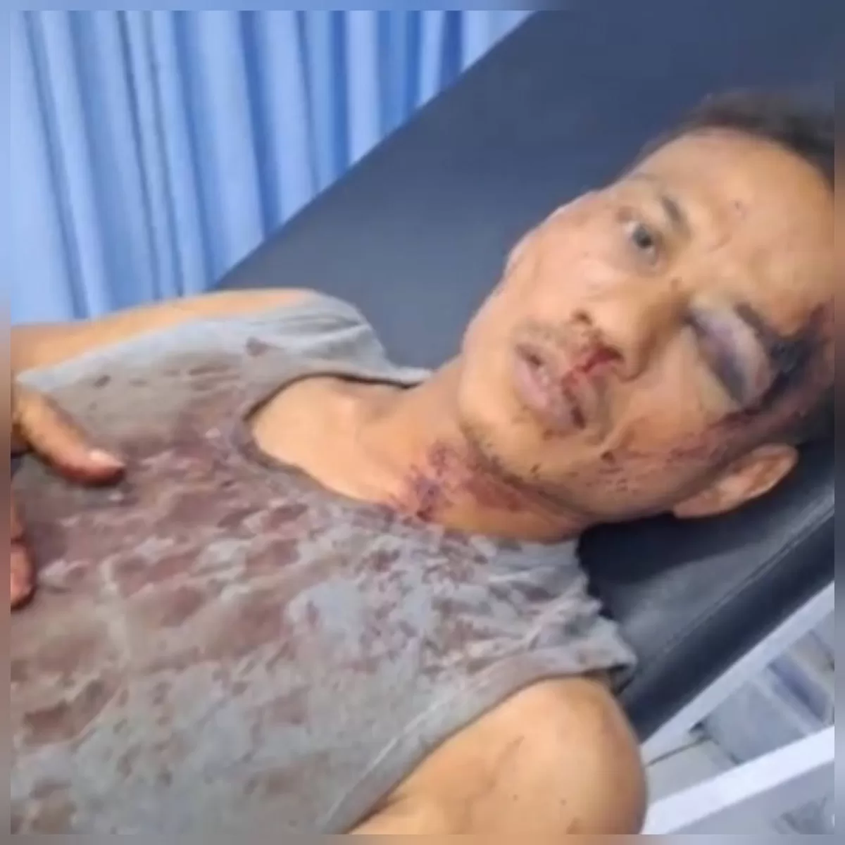 Foto Salah Satu Korban  (NAWACITAPOST.COM)