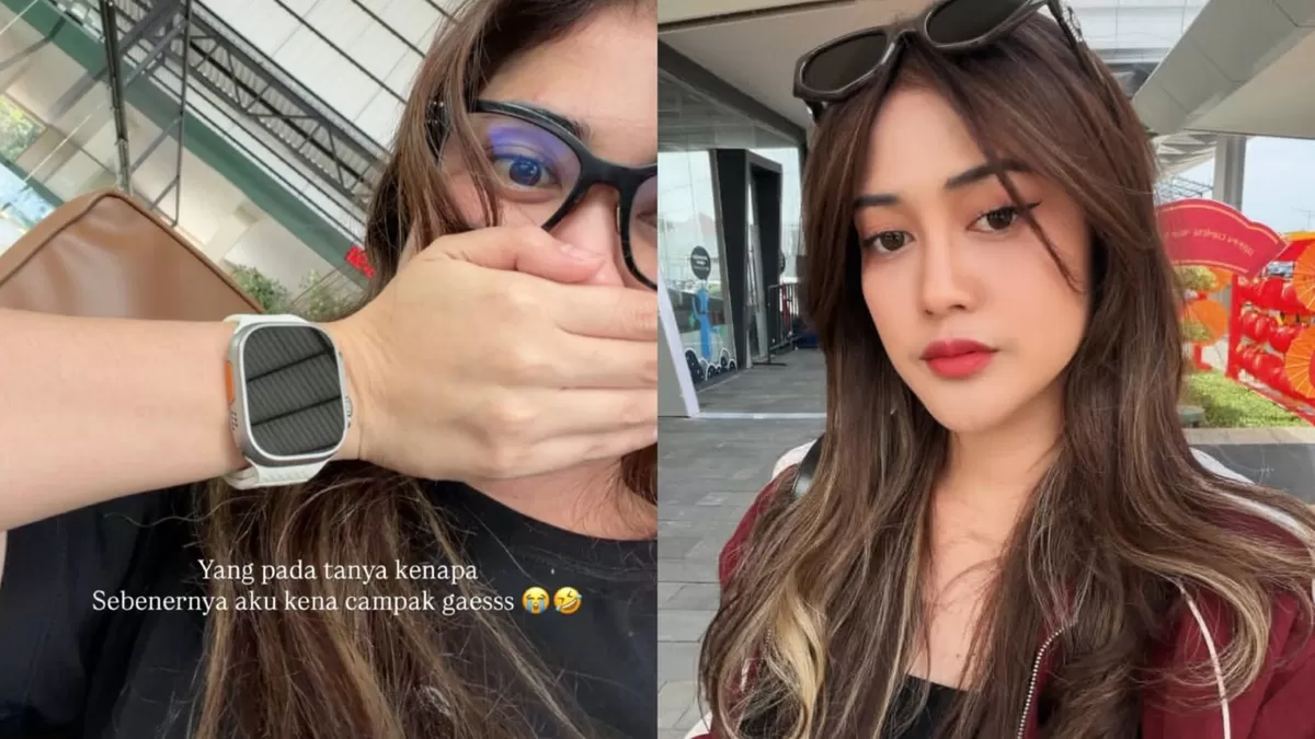 Selebgram Ruce Nuenda viral karena sempat berada di tempat umum saat sakit campak. (Instagram/rucenuenda)