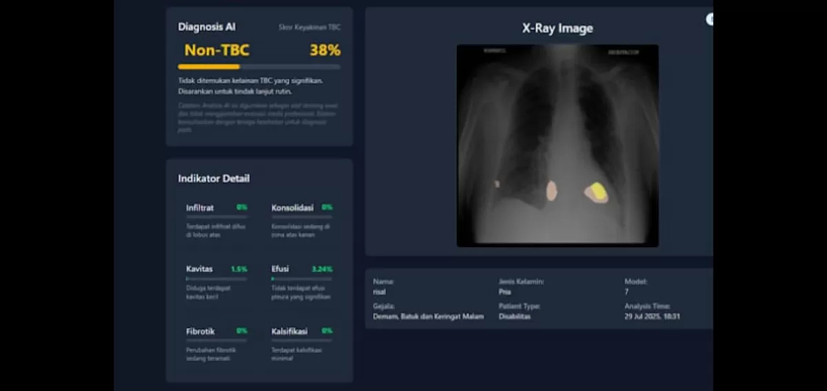 Tampilan layar TBScreen.Ai yang dikembangkan tim peneliti UGM Dok. Humas UGM