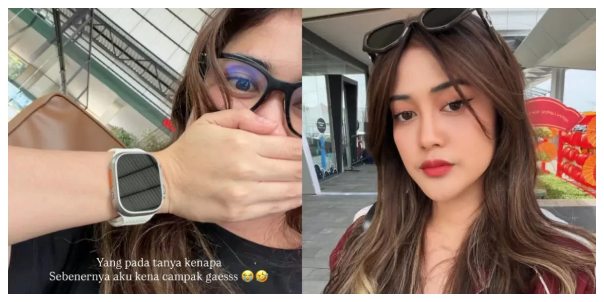 Selebgram Ruce Nuenda viral karena sempat berada di tempat umum saat sakit campak. (Instagram/rucenuenda)