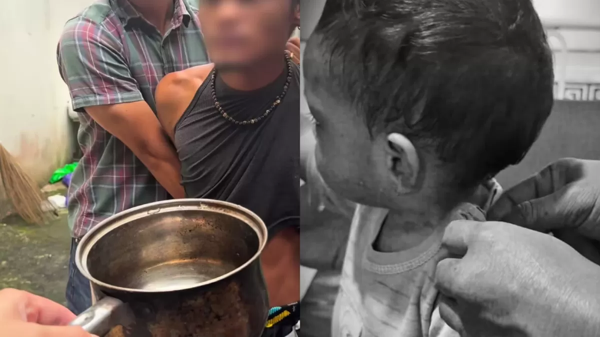 Tragis, balita ini dianiaya oleh ayah kandungnya sendiri oleh ayah kandung  ((Instagram/ghifariiman))