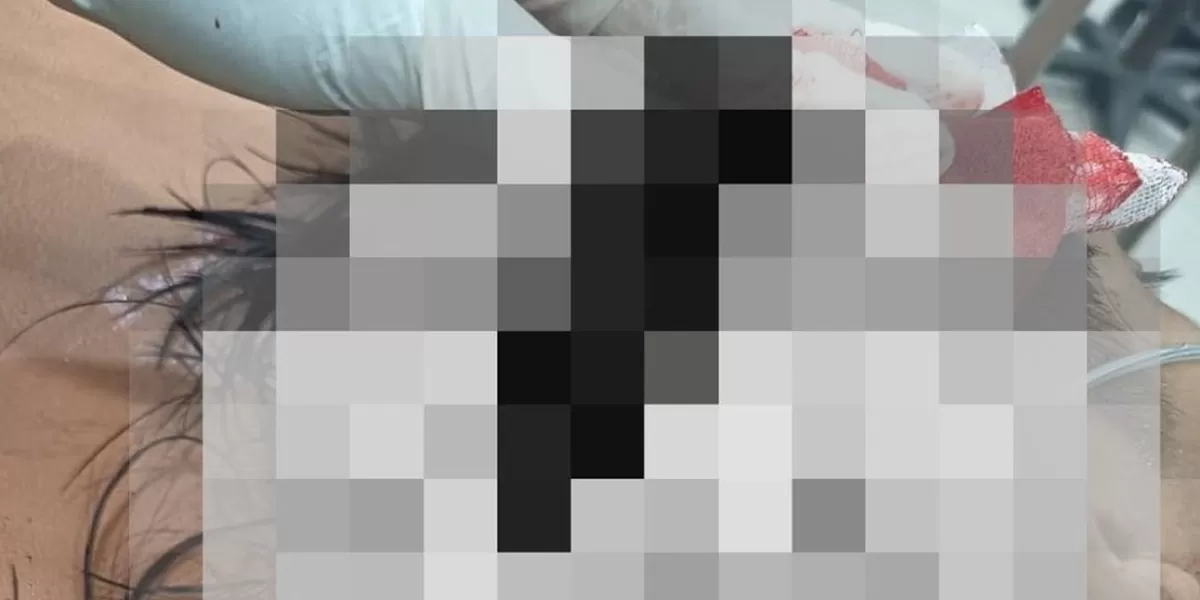 Korban sempat mendapatkan pertolongan medis di rumah sakit. Namun nyawanya tidak tertolong akibat luka sabetan benda tajam di bagian kepala dan paha kanan. (Realitasonline.id/Dok)