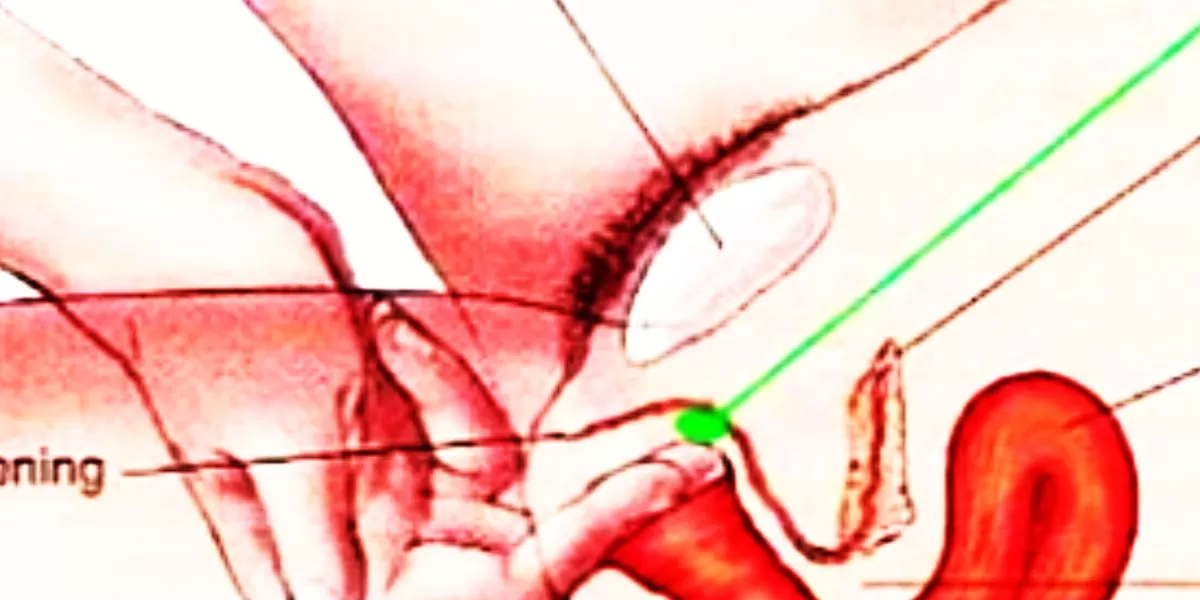 Misteri Grafenberg Spot ( G- Spot ),  banyak disebut sebagai titik tersensitif di wanita yang bila tersentuh bikin keni'matan tiada taranya bagi istri.