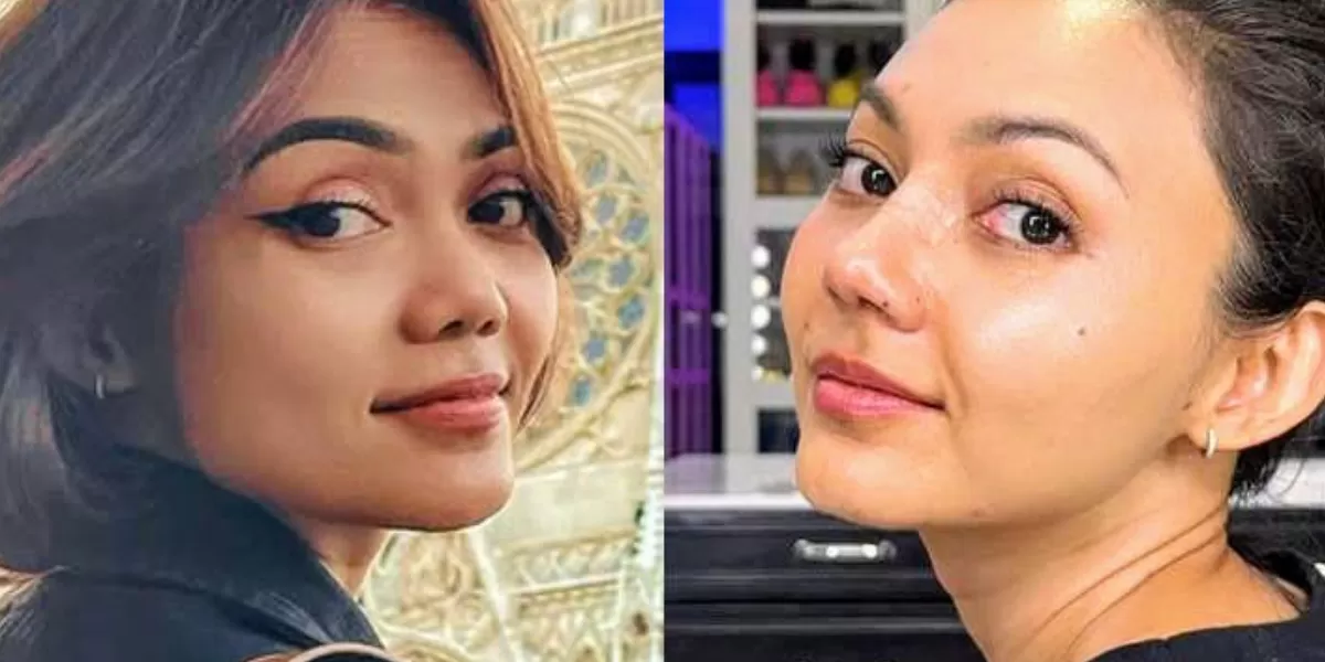 Rina Nose ungkap alasan operasi hidung dengan dokter Tompi di Indonesia. (Instagram @rinanose16)