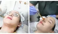 Pendekatan Menyeluruh Miracle Aesthetic Clinic, Tangani Hiperpigmentasi Kulit Pelanggan Indonesia