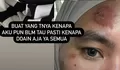 Terungkap Inilah Sakit Kartika Putri Hingga Harus Berobat ke Singapura