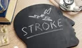 Mengenal Gejala Stroke dan Penanganannya